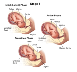 Stages of Labour